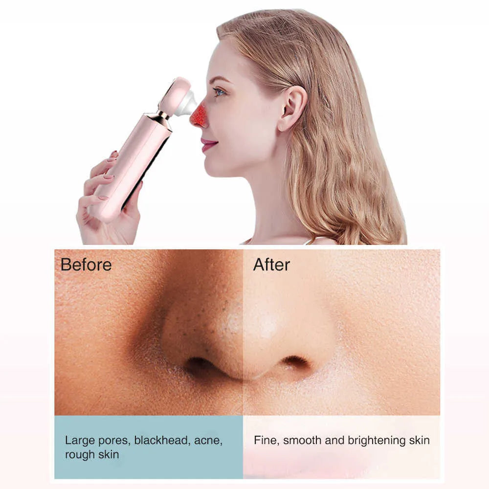 Noorayn™ Blackhead Suction Machine