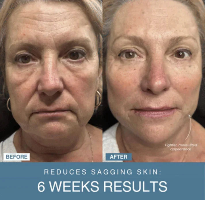 Noorayn™ 7-in-1 LED Anti-Aging/Wrinkle Apparatus