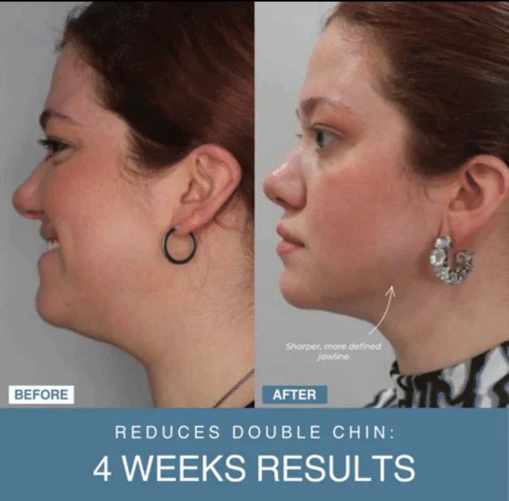 Noorayn™ 7-in-1 LED Anti-Aging/Wrinkle Apparatus