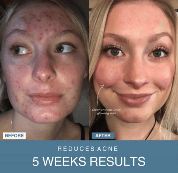 Noorayn™ 7-in-1 LED Anti-Aging/Wrinkle Apparatus